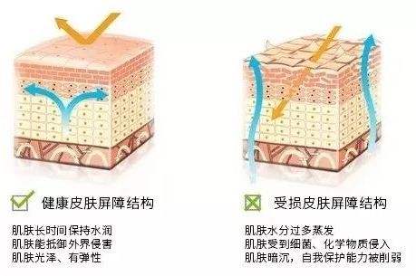 受损的肌肤屏障如何才能得到修复？