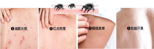 除螨净痘全靠它？干净型男的选择—左颜右色