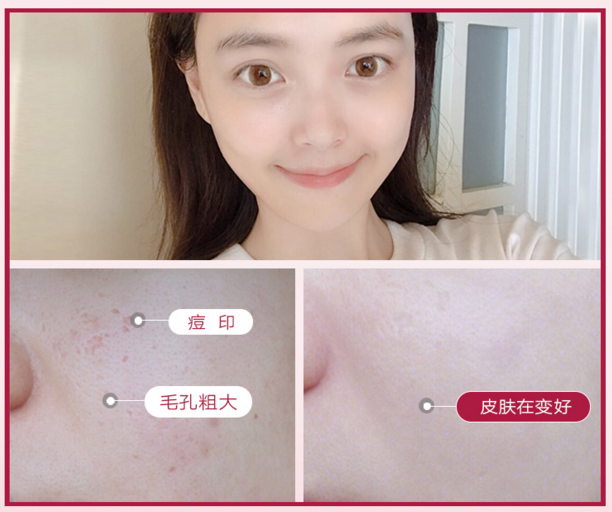Notime LED光疗仪让我体验了回院线级美容效果