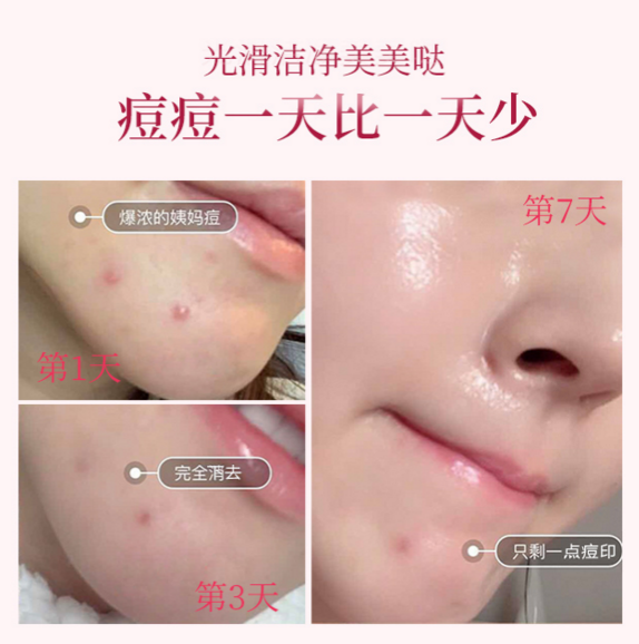 Notime LED光疗仪让我体验了回院线级美容效果