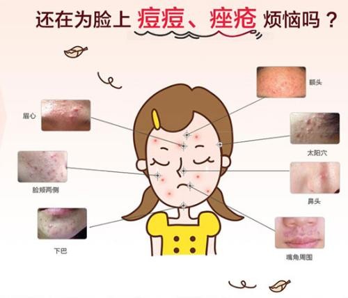 怎么去除痘痘？芦姬的祛痘霜效果怎么样？这些小知识你需要知道！